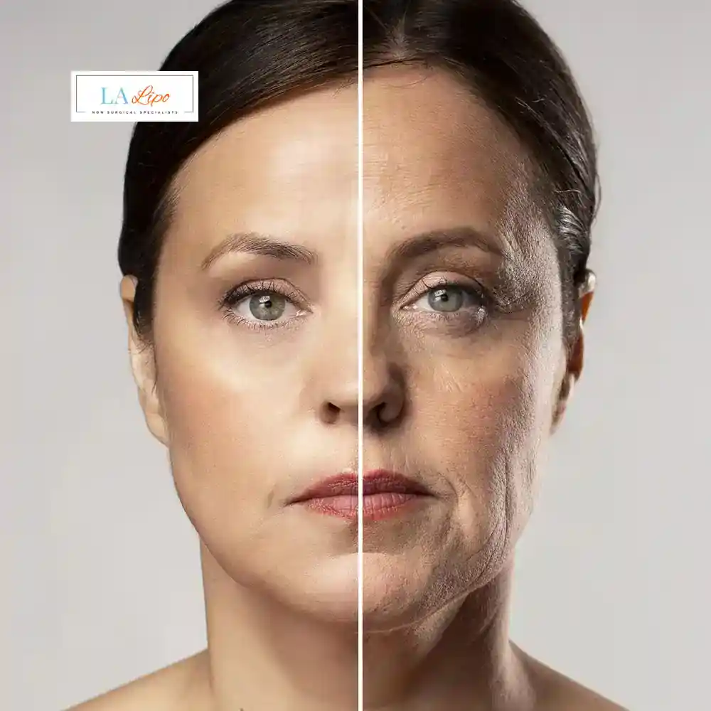 How Can You Tell If Non-Surgical Skin Tightening Is Right for You Barking and Dagenham?