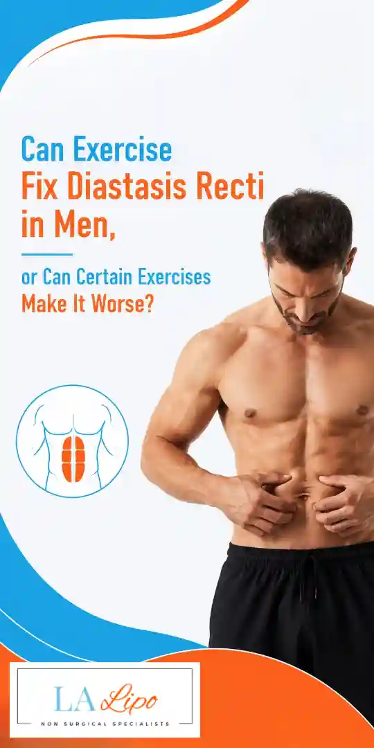 Can Exercise Fix Diastasis Recti in Men, or Can Certain Exercises Make It Worse Barking and Dagenham?